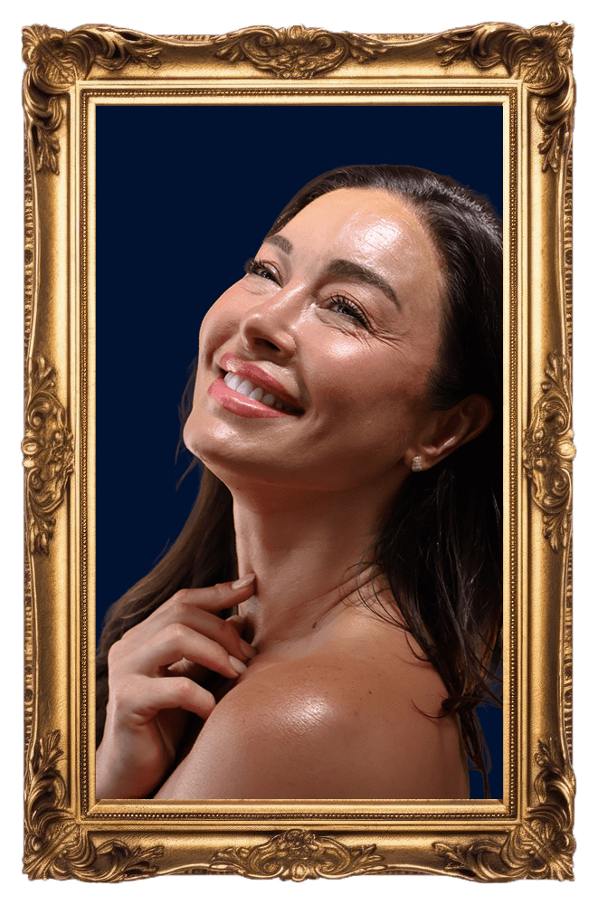 Wrinkle reduction